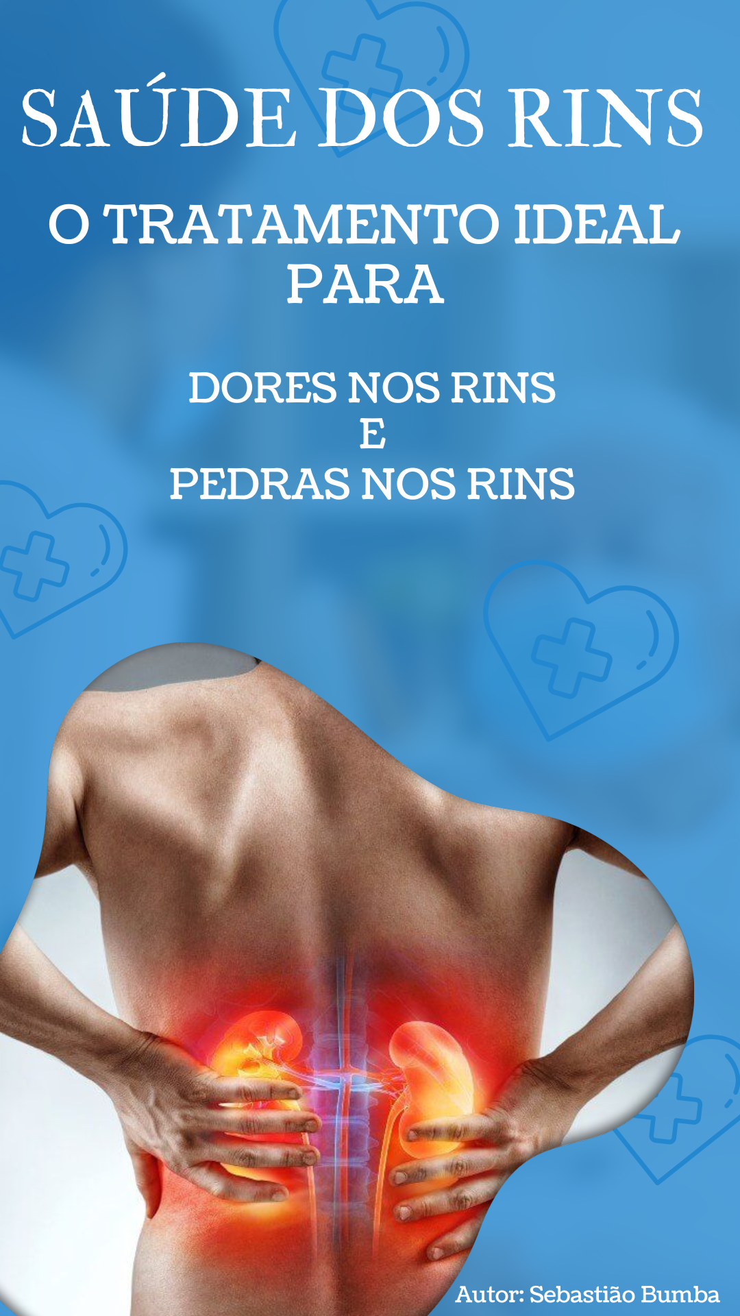 o_tratamento_ideal_para_dores_nos_rins_e_pedras_nos_rins_14190