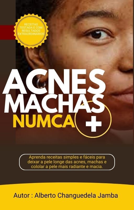 acnes_e_machas_numca_mais_5785